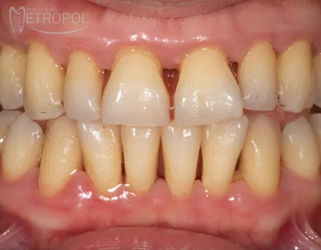 Periodontoloji